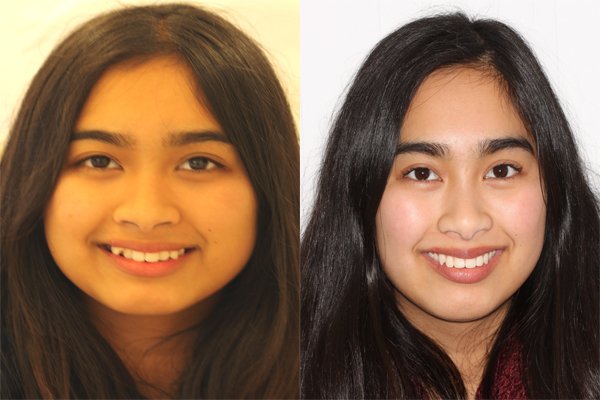 glenview dental treatment